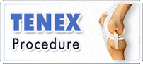 Tenex Procedure