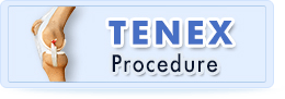 tenex-procedure-sub image